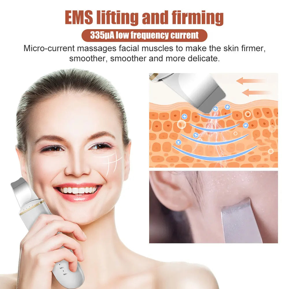 Ultrasonic Skin Scrubber & Blackhead Remover