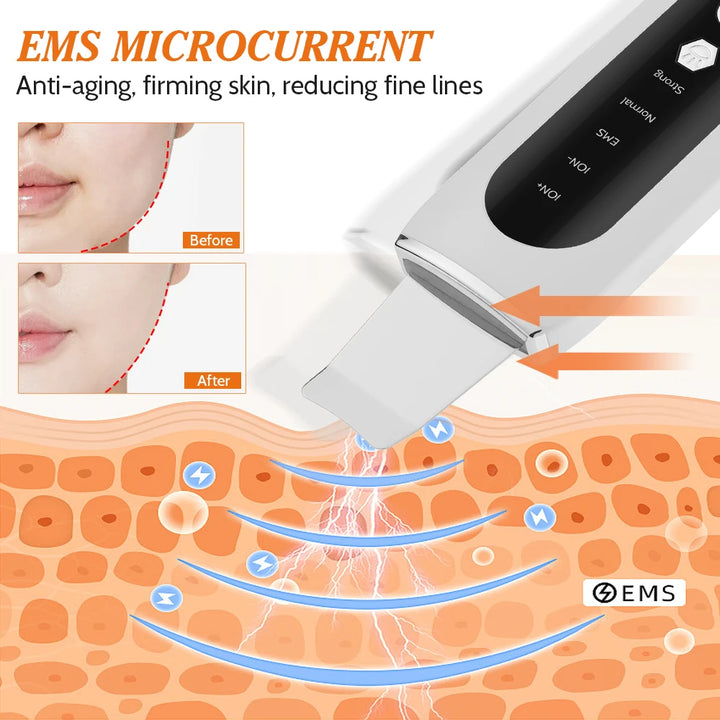 Ultrasonic Skin Scrubber