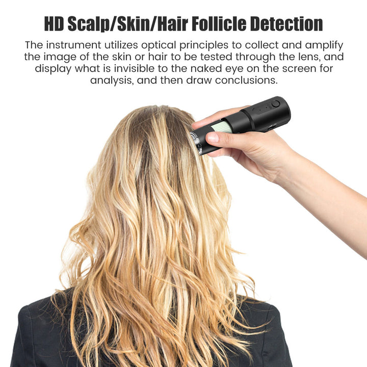 Wireless Dermatoscope Analyzer