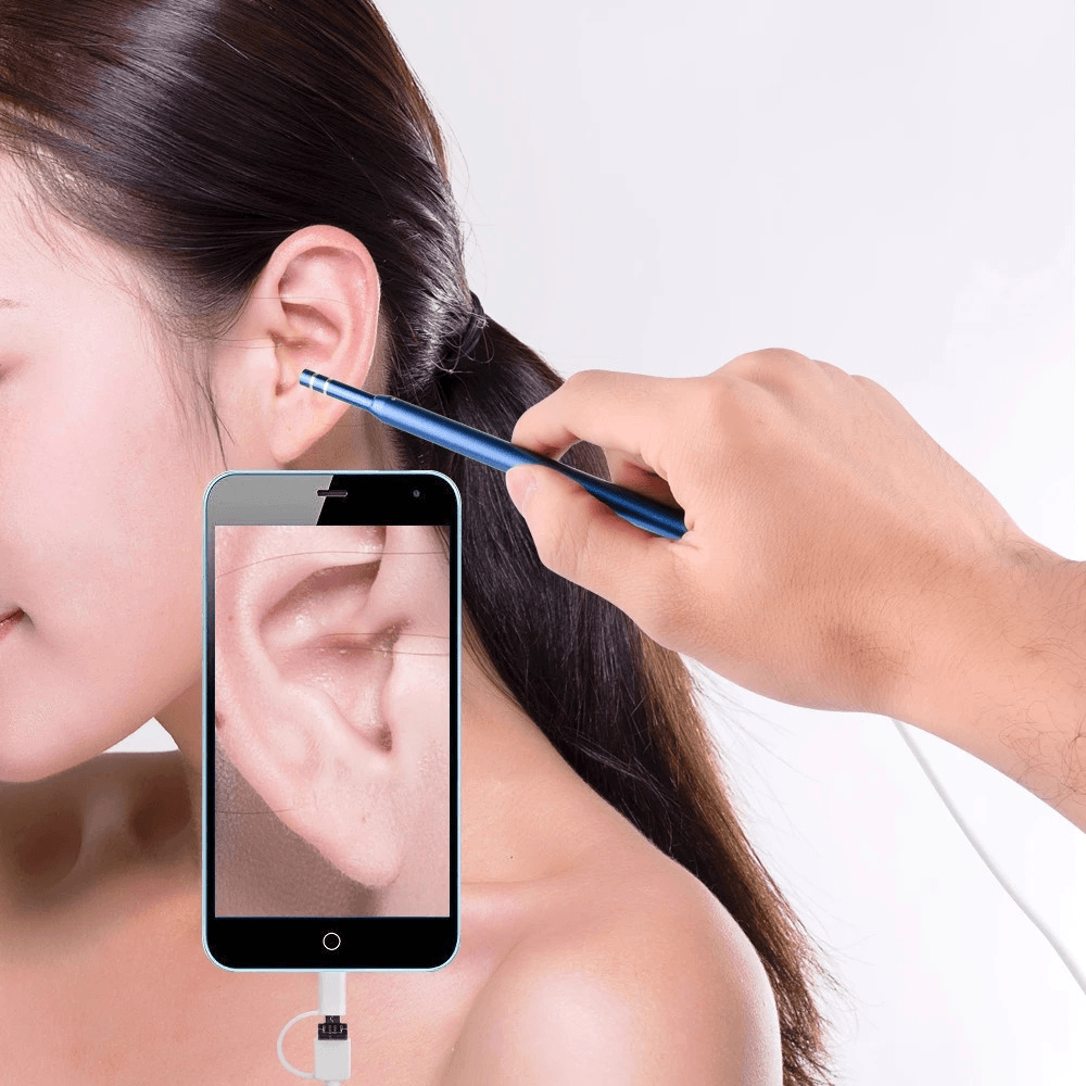 Ear Cleaning Endoscope 3 in 1 Visual Ear Spoon Multifunctional Earpick 5.5Mm HD Camera Ear Mouth Nose Otoscope for Android PC - Trendha