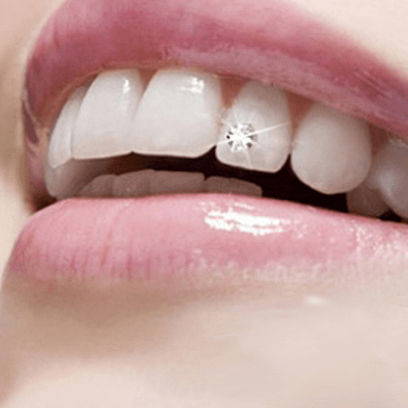 10Pcs Teeth Jewelry Beauty Make up Dental Tools Drill Diamond Crystal Ornament - Trendha