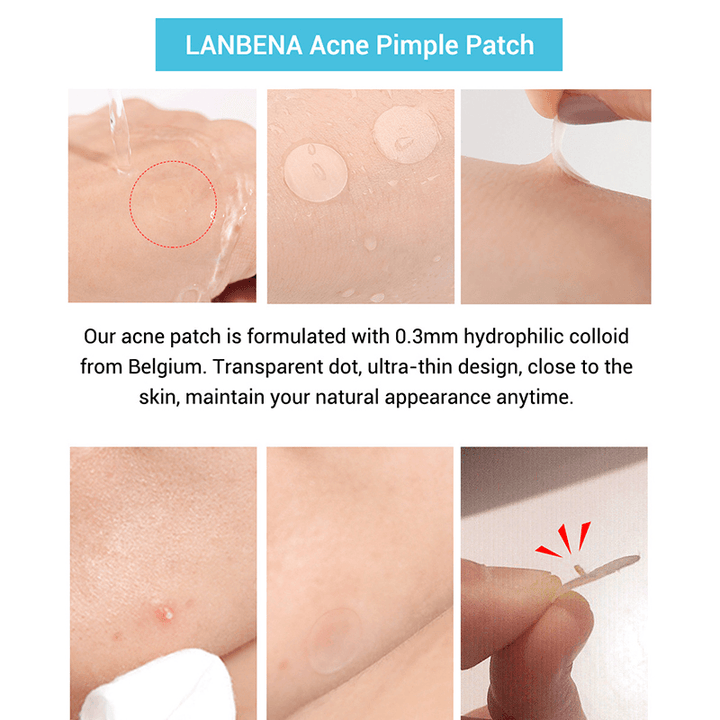 LANBENA Tea Tree Daily Acne Stickers + Night Acne Stickers Fade Blackhead Acne Remover - Trendha