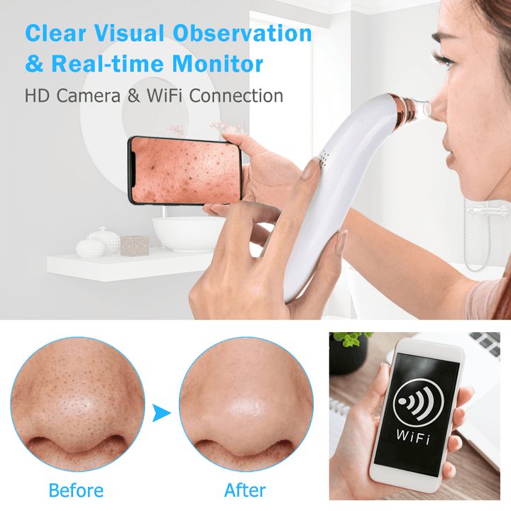Wifi Camera Visual Blackhead Remover Nose Cleaner Pore Acne Pimple Removal Vacuum Suction Facial Diamond Peeling Beauty Tools - Trendha