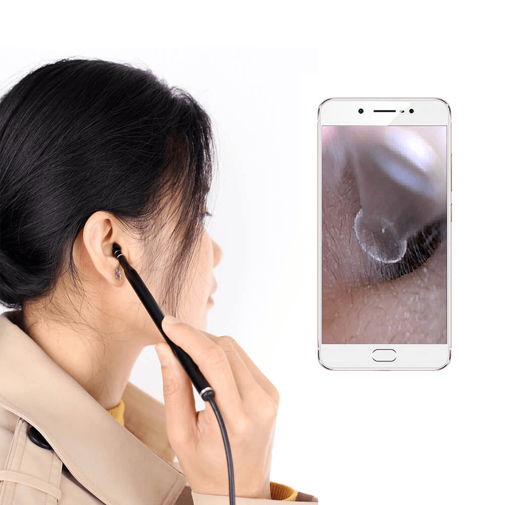 3-In-1 Ear Removal Camera Ear Wax Removal HD Visual Multifunctional Ear Cleaning Spoon - Trendha