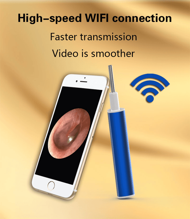 High Precision Wifi Otoscope Camera Smart Visual Ear Pick Cleaner HD Earpick Ear Spoon Earwax Removal - Trendha