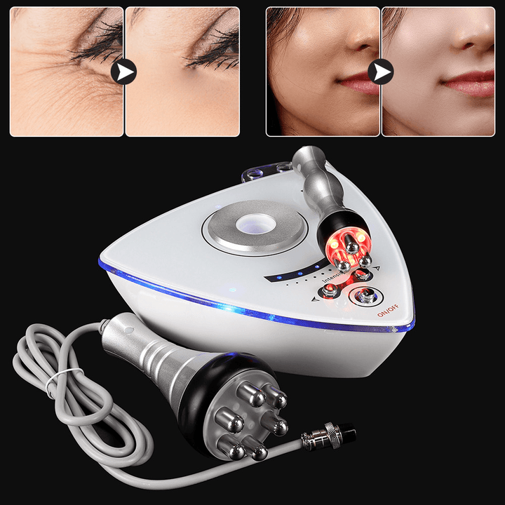 110V-220V Skin Rejuvenation Beauty Machine Multipolar RF Skin Tighten Anti-Wrinkle - Trendha