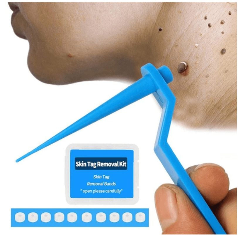 Skin Tag Kill Skin Mole Wart Remover Micro Band Skin Tag Removal Kit Adult Mole Wart Face Care - Trendha