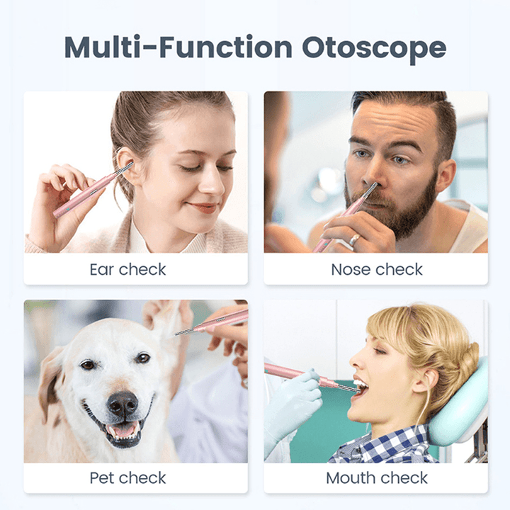 Smart Visual Ear Sticks Endoscope 300W High Precision Earpick Camera Mini WIFI Otoscope Health Care Ear Cleaner - Trendha