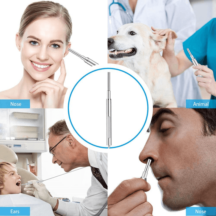 Otoscope 720P HD Ear Camera 3.9MM Usb Ear Cleaning Endoscope Heard Camera Ear Wax Removal Kit for Android Windows Macbook Device - Trendha