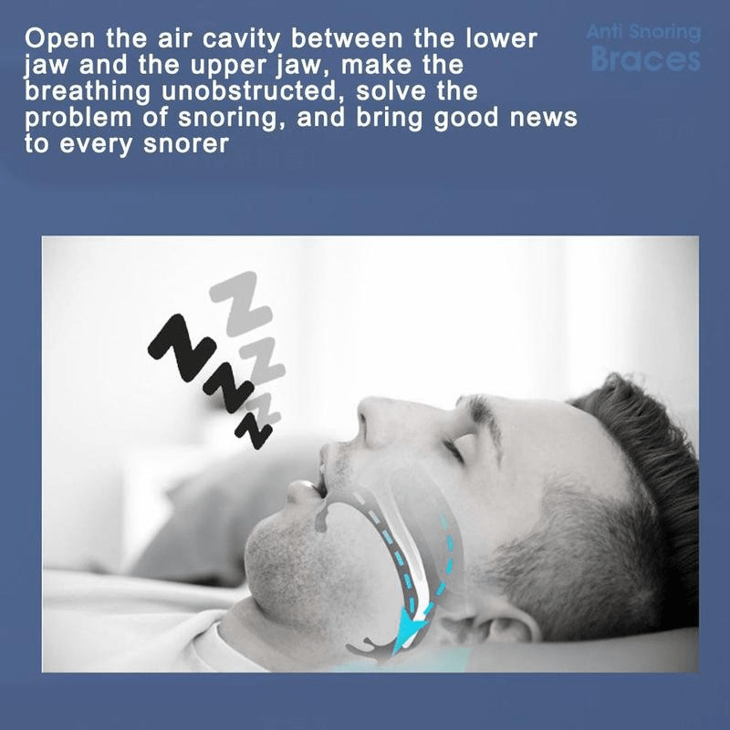Anti Snoring Braces 3Pc Portable Corrective Breathing Positioning Anti-Snoring Silicone Braces Sleep Prevention Snoring Device - Trendha