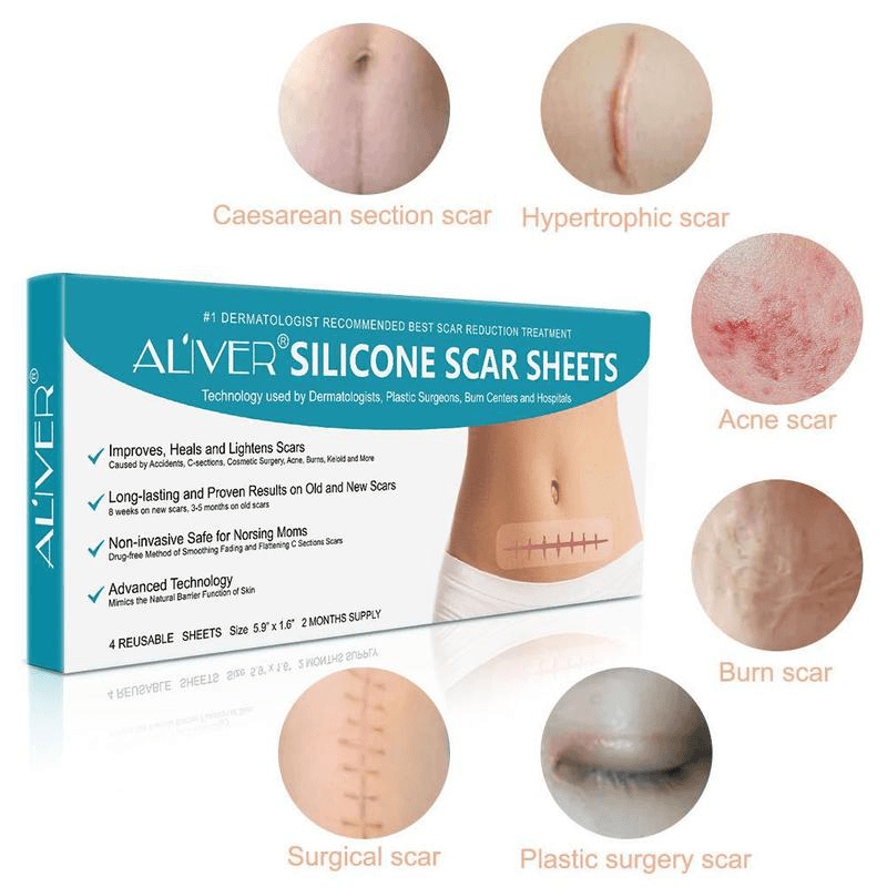 Silicone Surgical Scar Removal Patch Remove Trauma Burn Sheet Skin Repair Scar Removal Therapy Patch for Acne Scar Treatment - Trendha