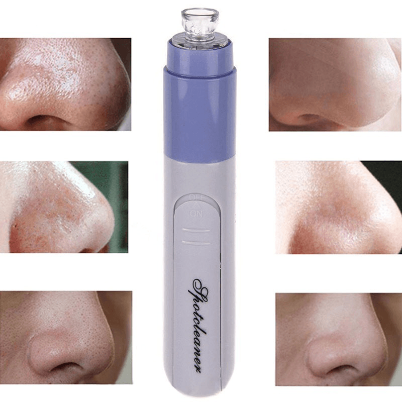 Electric Facial Pore Suction Spot Cleaner Blackhead Remover Acne Pimple Cleanser Lifting Firming Skin - Trendha