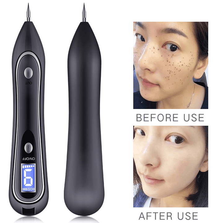 Skin Tag Repair Kit Portable Mole Remove Pen Professional Beauty Equipment - Trendha
