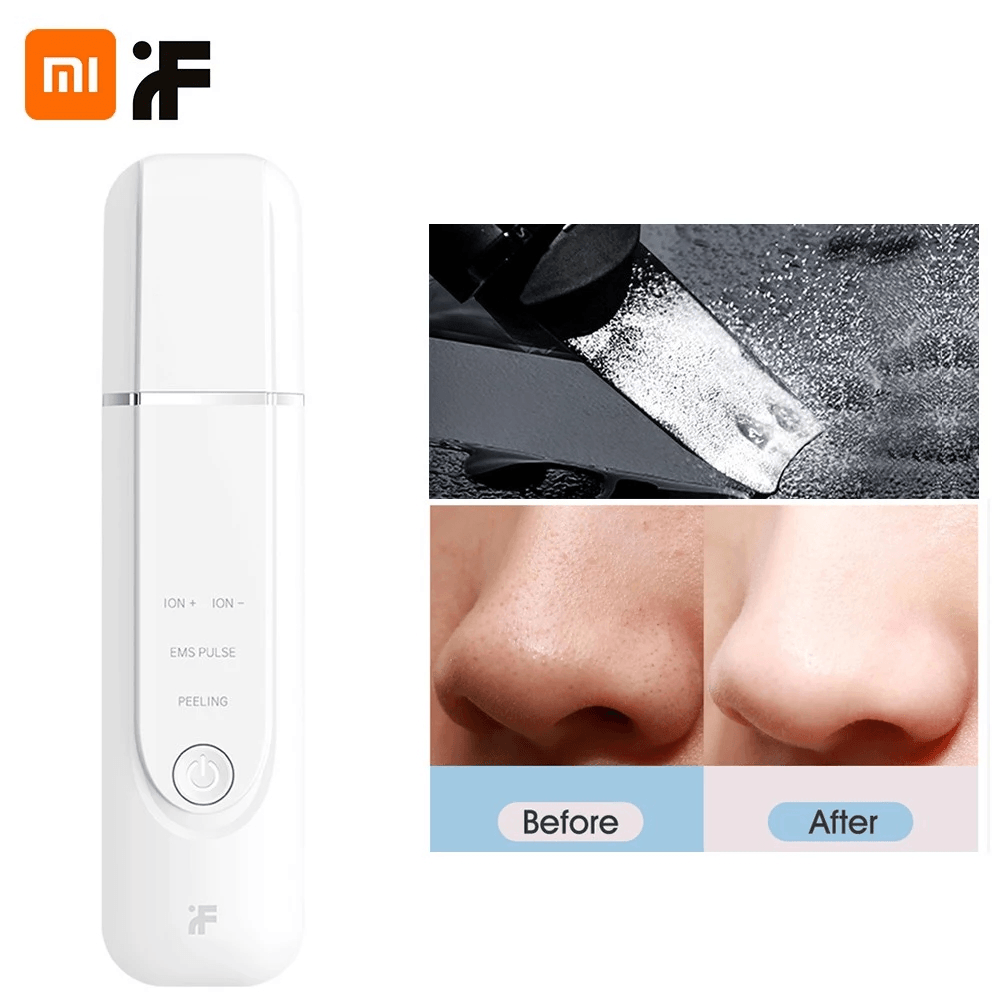 Inface Skin Scrubber Ultrasonic Ion Cleansing EMS Pulse Stimulation Facial Pore Cleaner Peeling Shovel High Frequency Vibration Facial Cleanser - Trendha